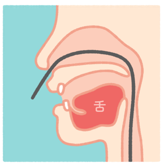 鼻からの胃カメラ