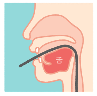 口からの胃カメラ